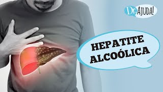 HEPATITE ALCOÓLICA E CIRROSE SINTOMAS DIAGNÓSTICO E TRATAMENTO [upl. by Aryaz478]