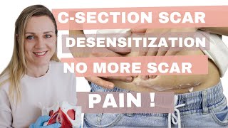 Csection scar desensitization no more scar pain Tips for better Csection recovery [upl. by Darnok]