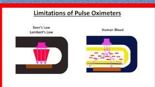 pulse oximetry [upl. by Greenes]