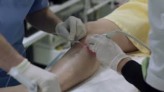 Endovenous Laser Ablation for Varicose Veins [upl. by Bryanty]