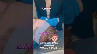 Botox for treatment of forehead and frown lines by Dr Sonia at Myra skin clinic botox antiaging [upl. by Callery]