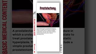 Prostatectomy prostatectomy prostatecancertreatment prostatecancerawareness [upl. by Enilram]