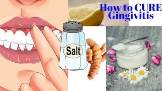 How to CURE Gingivitis With Turmeric Coconut Oil Baking Soda or LEMONS No dentist required [upl. by Solberg]