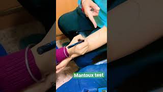 Mantoux test 🩸laboratory medical bmlt dmltvideo samplecollection 🥼💉💉 [upl. by Bazil97]