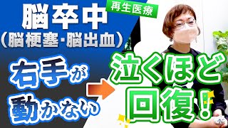 【脳卒中脳梗塞・脳出血の後遺症】再生医療（幹細胞）治療後のインタビュー・動かなかった右手が動いた、そして涙した！ [upl. by Radke852]