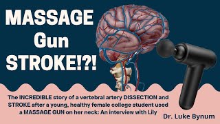 Massage Gun STROKE An incredible story of vertebral artery dissection after using a massage gun [upl. by Hannahoj236]