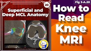 Fig 3A20 Superficial and Deep MCL Anatomy [upl. by Ellivnarg324]