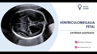 Ventriculomegalia fetal como avaliar [upl. by Lindley]