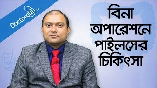 Piles treatment without surgery  Hemorrhoid Removal  অপারেশন ছাড়া পাইলস এর চিকিৎসা  Piles [upl. by Ansaev]