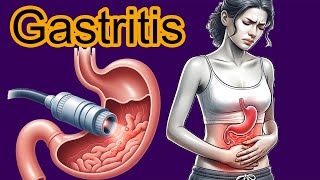 5 Early signs of Gastritis Gastritis diagnosis and treatment [upl. by Shig130]