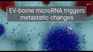 Small extracellular vesicles from ovarian cancer cells prep nearby areas for cancer spread [upl. by Lrae992]