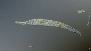 Interstitial Ciliates  Jaffa port [upl. by Tempest]