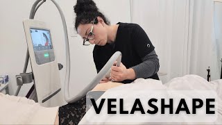 Shape Up with VelaShape III Your Ultimate Guide to Body Contouring [upl. by Aihseit717]