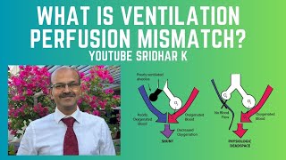 What is ventilationperfusion VQ mismatch How do we manage it neonatalventilation VQmismatch [upl. by Samtsirhc]