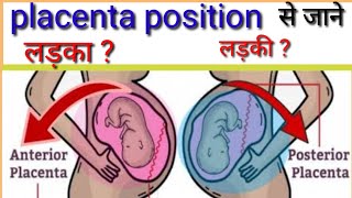 placenta posterior means baby boy  placenta anterior means baby girl  poonam90 [upl. by Lezirg]