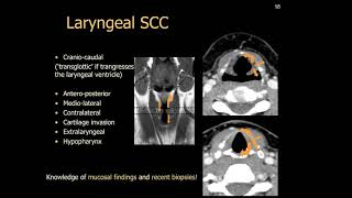 Imaging of larynx [upl. by Curt732]