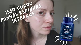 Peróxido de Benzoíla funciona para espinhas internas Como tratar a acne cística [upl. by Vescuso]