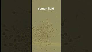 Semen fluid examination [upl. by Lanod]