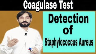 Coagulase Test  Procedure of Coagulase Test [upl. by Beckerman]