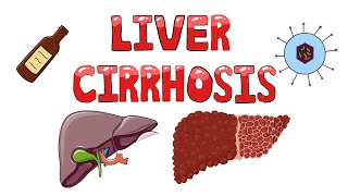 Liver Cirrhosis  What happens in Liver Cirrhosis  Pathophysiology Causes Signs amp Symptoms [upl. by Ecinna]