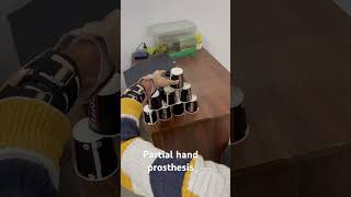 Advanced Functional prosthesis for partial hand amputationHandicare 9310304604 9990621774 [upl. by Huston683]