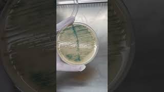 Burkholderia cepacia Trên Môi Trường Thạch UTI  Điều Bạn Cần Biết shorts labinsight [upl. by Aniratak]