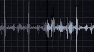 Pericardial Friction Rub Recording amp Waveform  Eko Health [upl. by Aisad]