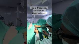 Radio frequency ablation for Hemorrhoids  Bleeding painful Piles treatment ​⁠DrAshishBhanot [upl. by Iila]