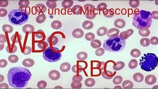 How to WBC count under Microscope [upl. by Ajtak]