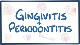 Gingivitis and periodontitis  causes symptoms diagnosis treatment pathology [upl. by Asoj]