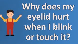 Why does my eyelid hurt when I blink or touch it  Most Asked Questions on Health [upl. by Ulita]