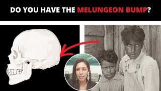 5 Common Traits of Melungeon Descent [upl. by Petronilla]