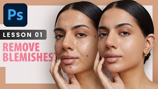 Remove Blemishes  Photoshop Retouching Course  Lesson 1 [upl. by Essilec759]