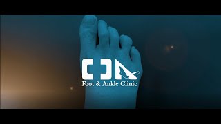 Minimally Invasive Mild Tailors Bunion Surgery [upl. by Annawal]