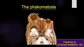 3Phakomatosis [upl. by Vonni945]