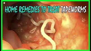 4 Effective Home Remedies To Treat Tapeworms In Humans  Best Home Remedies [upl. by Wilen344]