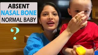 Absent Nasal Bone Normal Baby जानिए अब आगे क्या  NT Scan Details in Hindi [upl. by Townshend]