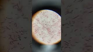 Lactobacillus bacteria under microscope  bacteria in curd [upl. by Nor]