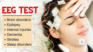 EEG test How brain is tested is that safe how EEG test is done [upl. by Nobie68]