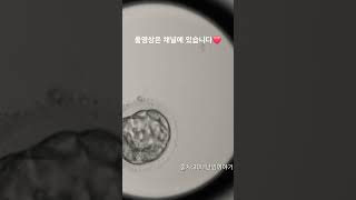 모자이시즘 배아 분열과정 Embryoscope timelapse 시험관 난임 5일배양 모자이시즘 pgt염색체 배아분열과정 [upl. by Aramen874]