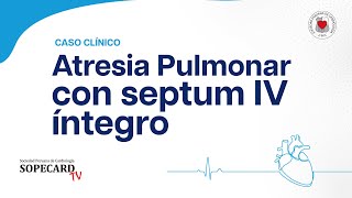 Cardiología  Caso Clínico Atresia Pulmonar con septum IV íntegro  SOPECARD TV [upl. by Trask656]