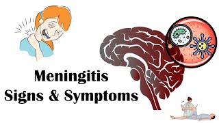 Meningitis  Signs amp Symptoms Most Common Signs amp Symptoms Of Meningitis [upl. by Aynom]