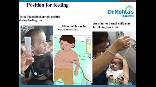 Button Gastrostomy Feeding [upl. by Oivatco]