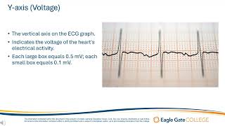 The ECG Graph [upl. by Zaremski]