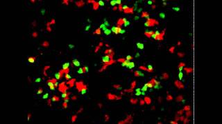 Twophoton microscopy of Bone marrow derived DCT cell interaction [upl. by Alaine]