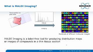 MALDI Imaging Reveals New Insight into Glycosylation and Glycan Distributions [upl. by Aiekram]