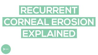 Recurrent Corneal Erosion RCE  RCE Causes and Treatment Options [upl. by Yentrac]