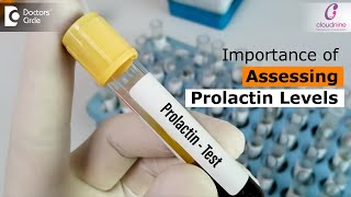 Prolactin Levels High in Women  Prolactin Test Prolactin Hormone Dr Aruna KumariDoctors Circle [upl. by Mungam]