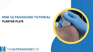 Musculoskeletal ultrasound of the plantar plate in the foot [upl. by Tadashi547]