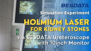 Simulation Experiment Holmium Laser for Kidney Stones via BESDATA Ureteroscope with 10inch Monitor [upl. by Eceeryt]